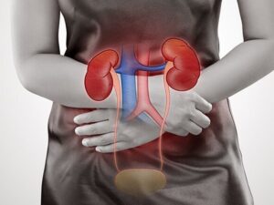 Acute kidney failure – loss of kidneys filtering ability 1 1200x900 1