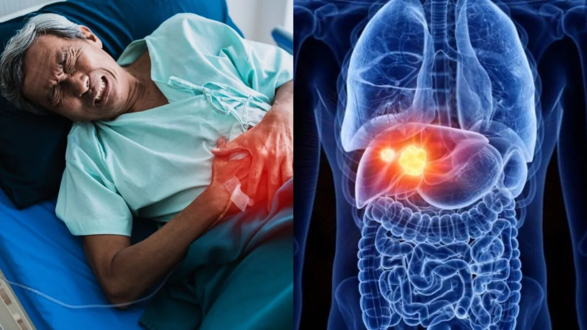 Foods for Liver Health