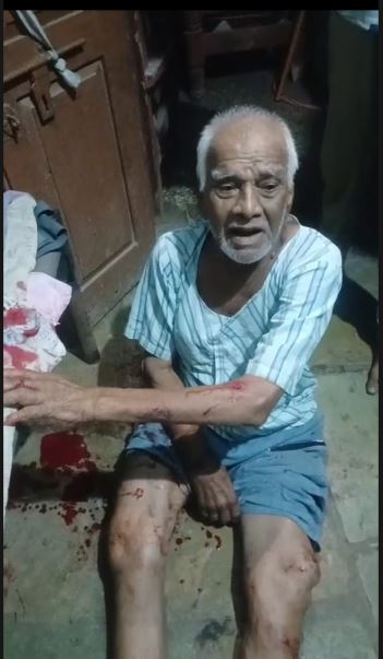 Dhar जिले के धरमपुरी क्षेत्र में बुजुर्ग दंपति के घर लूट, मारपीट के बाद लाखों के जेवरात ले उड़े चोर; ग्रामीणों में दहशत और आक्रोश