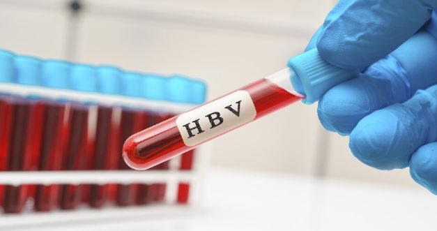 World Hepatitis Day 2026: किन लोगों को जरूर कराना चाहिए हेपेटाइटिस टेस्ट? डॉक्टर ने बताई वजह