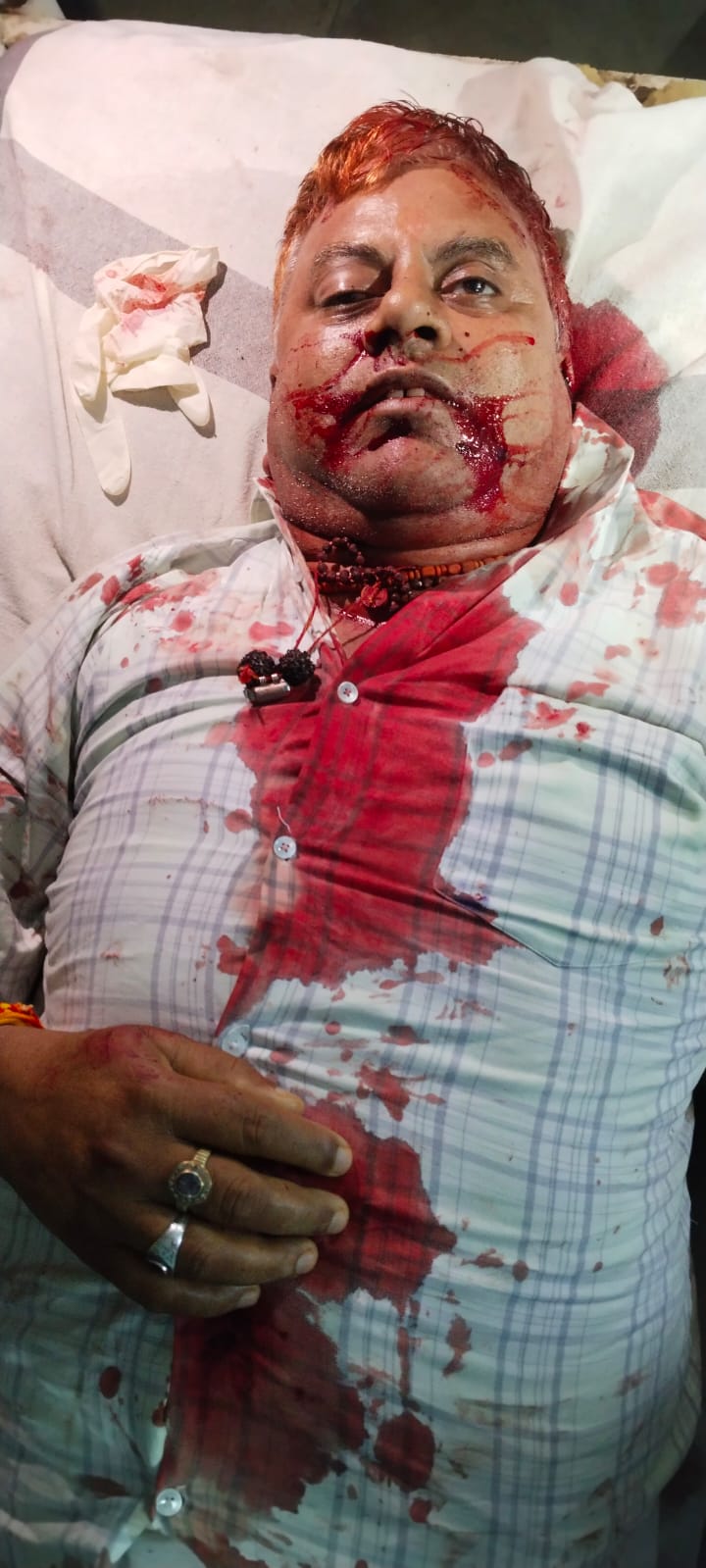Ratlam : पैदल टहल रहे शराब दुकान के मैनेजर को बाइक सवार ने मारी टक्कर, इलाज के दौरान मौत