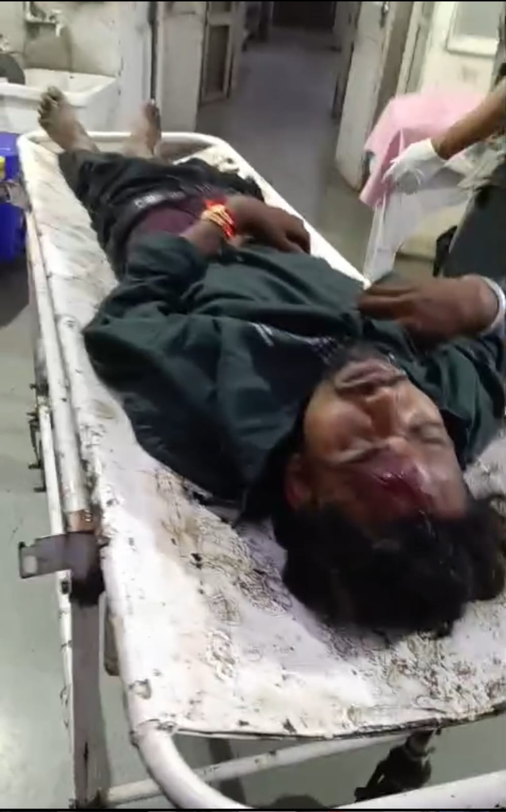 गंधवानी में 3 बाइक सवार घायल, एंबुलेंस नहीं मिली तो भैयालाल भाबर बने मददगार; निजी वाहन से पहुंचाया अस्पताल