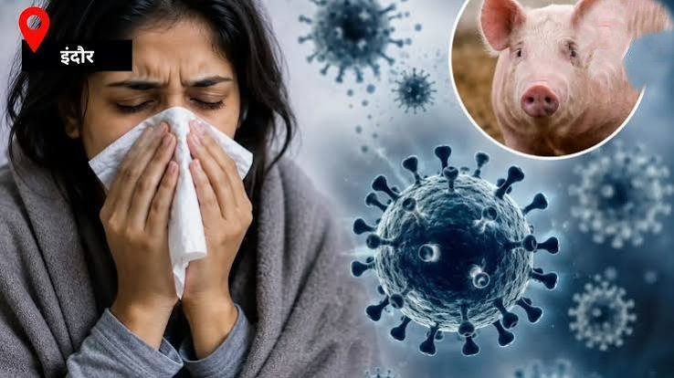 MP में Swine Flu का अलर्ट: महिला की मौत के बाद 3 नए संक्रमित, इंदौर-उज्जैन तक बढ़ी चिंता