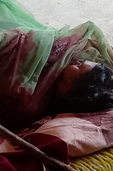 खेत में बने मकान में अकेली रह रही 55 वर्षीय विधवा की हत्या, सिर पर भारी वस्तु से हमले की आशंका